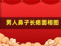 男人鼻子长痣面相图(男人鼻子长痣面相图解女人)