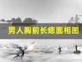 男人胸前长痣面相图(男人胸前长痣看相图解)