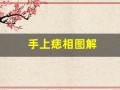 手上痣相图解