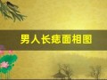 男人长痣面相图(男人长痣是什么意思)