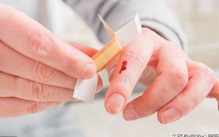 梦见别人流血(梦见自己流好多血)
