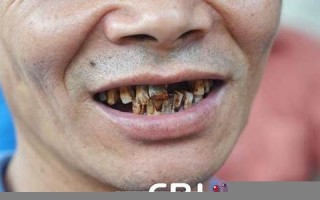 周公解梦 梦见掉牙齿(周公解梦梦见掉牙齿是什么征兆男人)